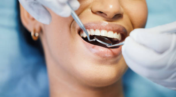 Best Emergency Dental Care for Sports Injuries in Dland, MI